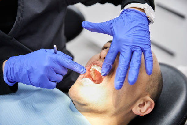 Best Emergency Dentist for Knocked-Out Tooth in Manhattan Beach, CA