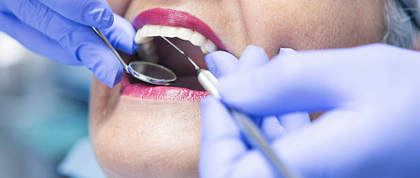Best Pediatric Emergency Dentist in Manhattan Beach, CA